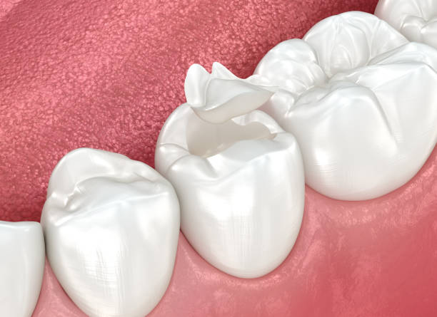 Best Wisdom Tooth Removal  in Shiloh, PA